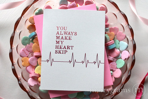 Valentines Card | You Always Make My Heart Skip 